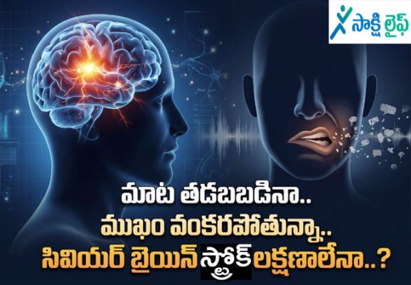 Severe Brain Stroke : మాట తడబబడినా.. ముఖం వంకరపోతున్నా.. సివియర్ బ్రెయిన్ స్ట్రోక్ లక్షణాలేనా..?