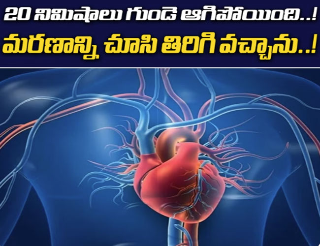 20 నిమిషాలు గుండె ఆగిపోతే మనిషి బతుకుతాడా..? 