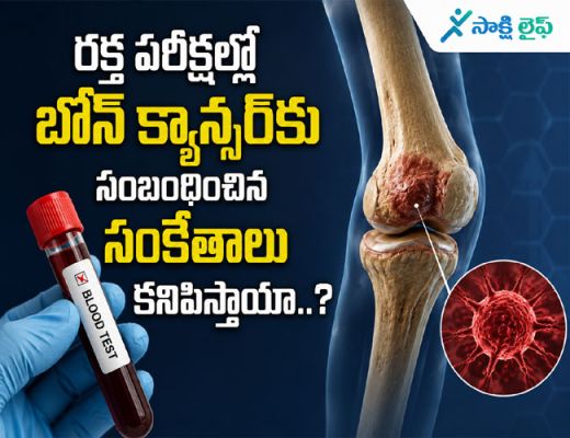 Signs of Bone Cancer : రక్త పరీక్షల్లో బోన్ క్యాన్సర్‌కు సంబంధించిన సంకేతాలు కనిపిస్తాయా..?