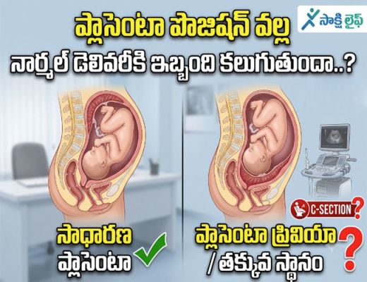 Placenta position : ప్లాసెంటా పొజిషన్ వల్ల నార్మల్ డెలివరీకి ఇబ్బంది కలుగుతుందా..?