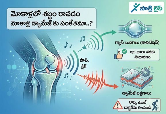 Knee Damage : మోకాళ్లలో శబ్దం రావడం మోకాళ్ల డ్యామేజ్ కు సంకేతమా..?