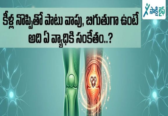 Joint Pain : కీళ్ల నొప్పితో పాటు వాపు, బిగుతుగా ఉంటే అది ఏ వ్యాధికి సంకేతం..?
