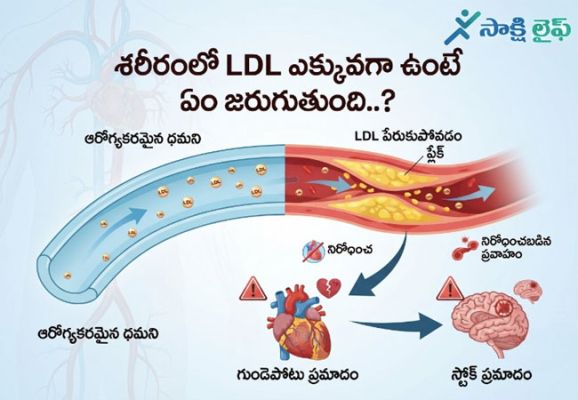 LDL Cholesterol Levels : శరీరంలో LDL ఎక్కువగా ఉంటే ఏం జరుగుతుంది..? 
