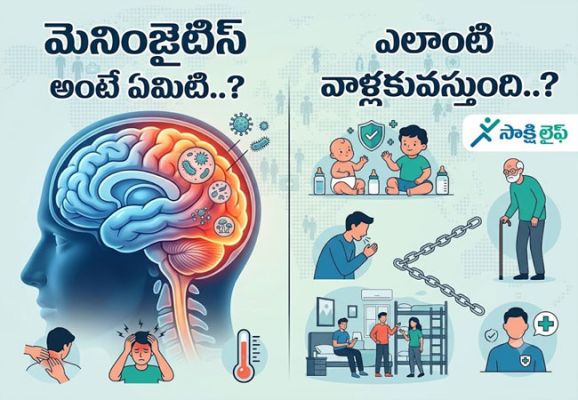 Meningitis : మెనింజైటిస్ అంటే ఏమిటి..? ఎలాంటి వాళ్లకువస్తుంది..?
