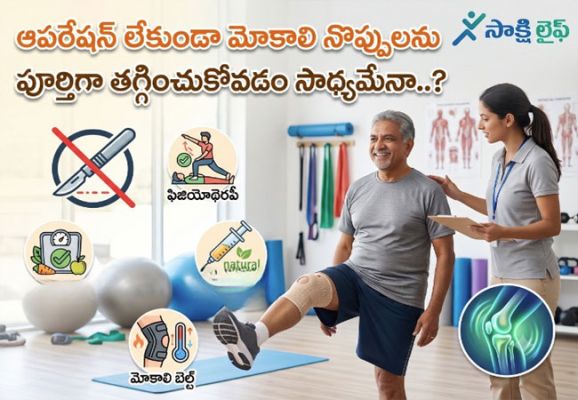 Knee Pain Without Surgery : ఆపరేషన్ లేకుండా మోకాలి నొప్పులను పూర్తిగా తగ్గించుకోవడం సాధ్యమేనా..? 